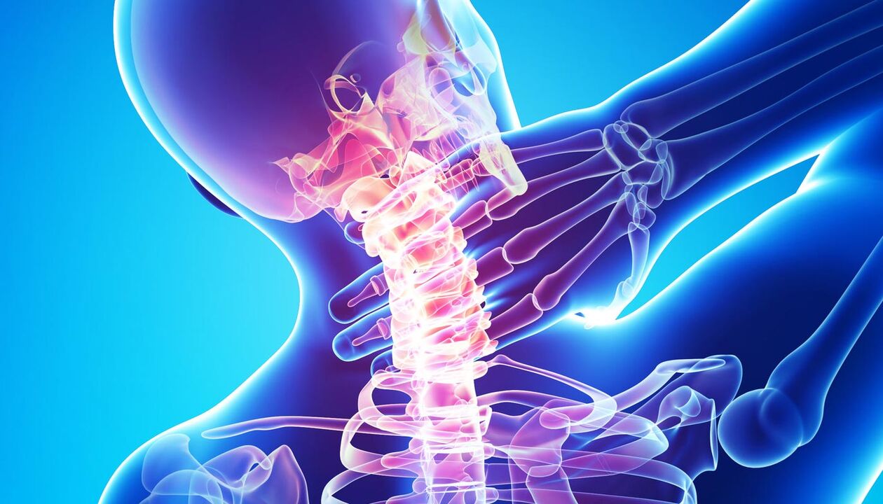 lepoko mina osteokondrosiaren ondorioz