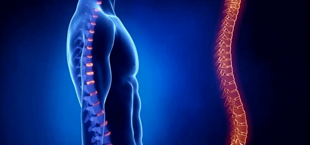 osteokondrosiaren ondorioz bizkarrezurreko lesioak